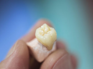 dental prosthesis 2021 08 26 18 26 32 utc 2