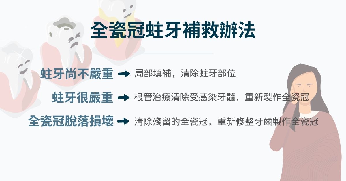 全瓷冠蛀牙補救辦法可能為清除蛀牙部位、根管治療或是重做全瓷冠